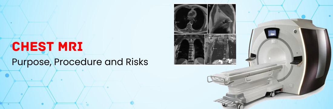 Chest MRI: Purpose, Procedure and Risks